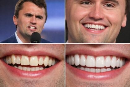 Charlie Kirk Teeth: The Full Breakdown