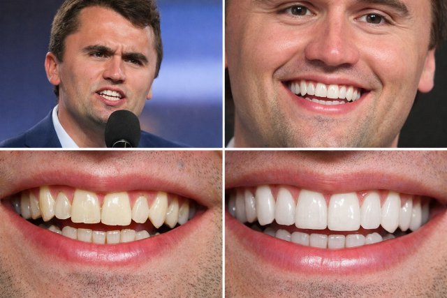Charlie Kirk Teeth: The Full Breakdown